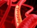 Blood vessels Medcurator